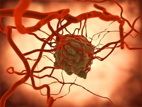 Can We Eat to Starve Cancer with Anti-Angiogenesis Foods? | Forks Over