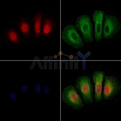 Phospho Gsk Alpha Beta Tyr Tyr Antibody Affinity Biosciences