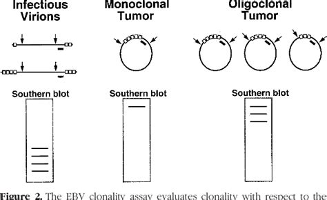 Figure 2 From Molecular Diagnosis Of Epstein Barr Virus Related Diseases Semantic Scholar