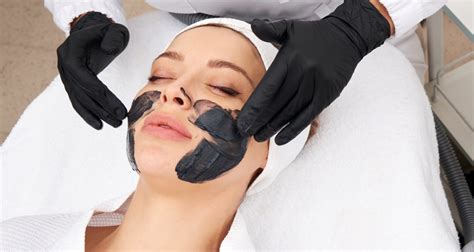 Carbon Laser Facial • Lynton Lasers