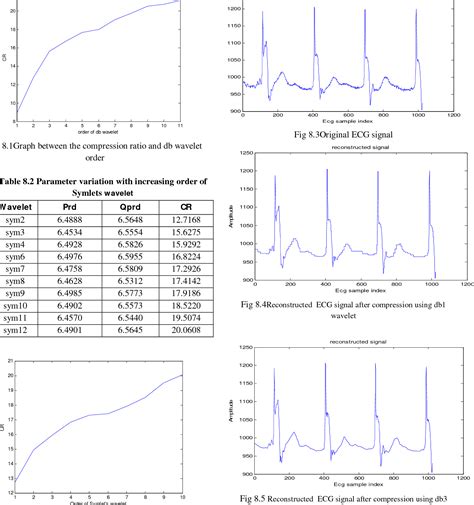 Figure From Analysis Of Ecg Signal Compression Technique Using