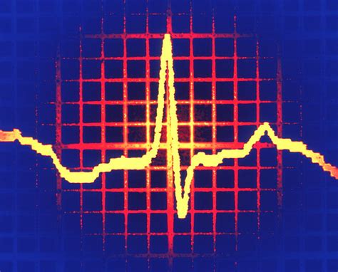 ecg trace photograph  pasieka fine art america