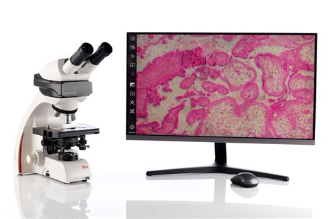 Dm Binocular Fluorescence Capable Microscope For Postdocs In The