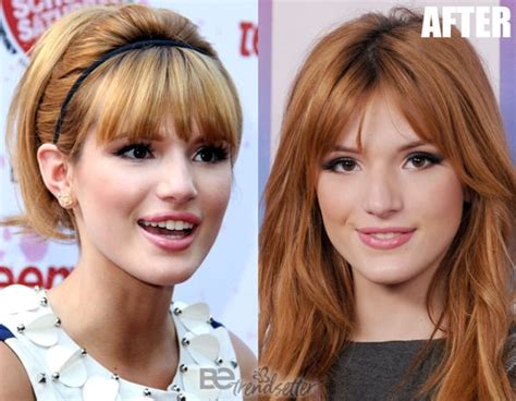 Bella Thorne Nose Job Before And After