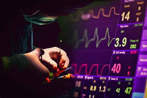 Revised Cardiac Risk Index For Pre Operative Risk Rcri Online