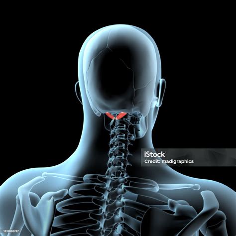 3d Illustration Of The Rectus Capitis Posterior Major Muscles Anatomical Position On Xray Body