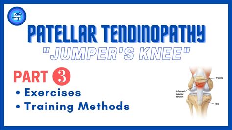 Patellar Tendinopathy Jumpers Knee Rehab For Fencers Part 3 Exercises And Methods Youtube