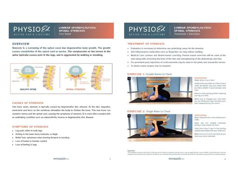 Printable Spinal Stenosis Exercises Pdf Physio Ed