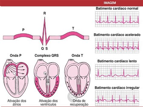 Eletrocardiograma Ecg