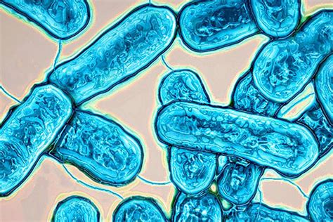 Legionella Bacteria Risks In Hot And Cold Water Systems Ignis Group