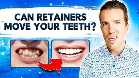 retainers cut  mouth  laura stanley blog