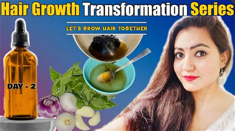 EXTREME HAIR GROWTH TRANSFORMATION CHALLENGE Day 2 Fix Thin Dull