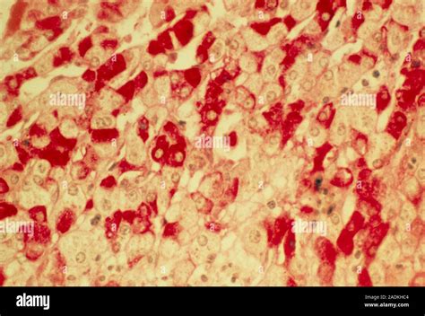 Glycogen Storage Light Micrograph Of A Section Through Liver Cells