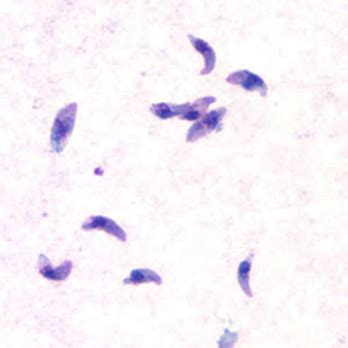 Toxoplasma Protozoa Found In Tissue Flashcards Quizlet