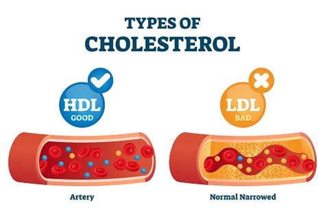 LDL is the Bad Cholesterol in Body! How to get rid of it? | Bowtie