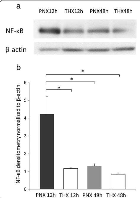 Western Blot Analysis Of Nf κb A Representative Western Blot Analysis