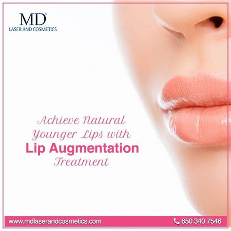 Lip Augmentation Treatment Artofit