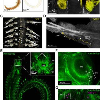 Whole-body immunolabeling of the juvenile axolotl nervous system. (A)... | Download Scientific ...