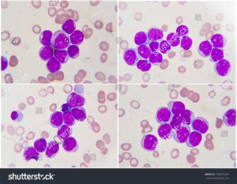 Blood Under Microscope 1000X : Red Blood Cells Under Microscope 1000x ...