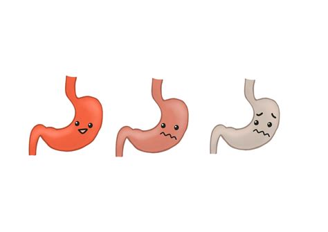 スキルス胃がんステージ4と言われた時の余命は？治療効果は？