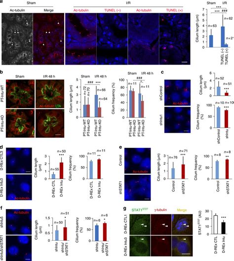 Regulation Of Primary Cilia By Intu And Stat1 A Cilium Length And Cell