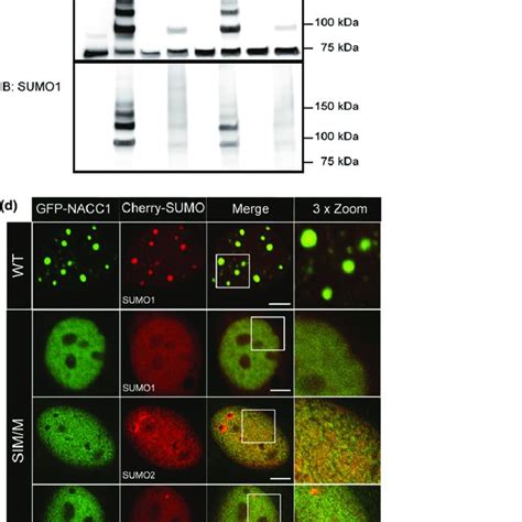 Confocal Immunofluorescence Observations Of GFP Nucleus Accumbens