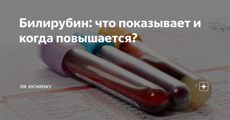Билирубин: что показывает и когда повышается? | Dr. Kichinsky. О ...