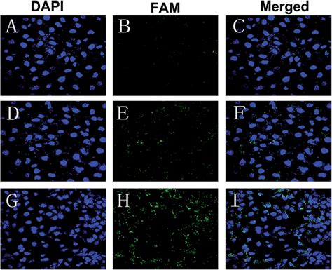 Confocal Laser Scanning Microscopy Images Of Cne Cells Transfected