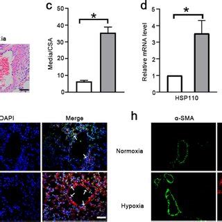 HSP110 Knockdown Attenuates The Development Of PAH Induced By Hypoxia