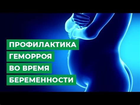 Профилактика геморроя во время беременности - YouTube