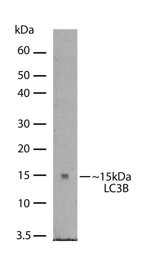 Lc3b Recombinant Polyclonal Antibody Invitrogen™ 100 μg Unconjugated