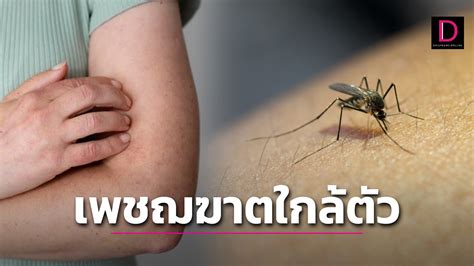 Dengue Fever Causes Symptoms Treatment And Prevention Archyde