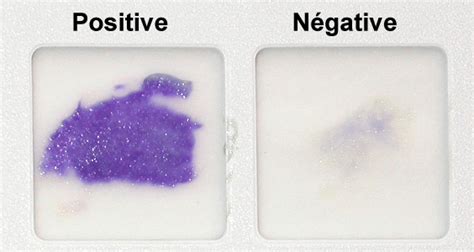 Difference Between Positive and Negative Oxidase Test | Compare the Difference Between Similar Terms