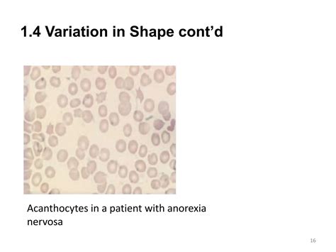 Hema Ii Chapter 2rbc Morphology Studyatppt