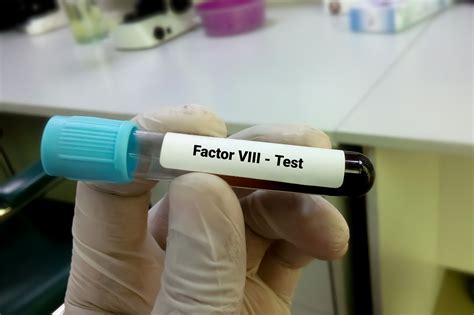 Altuviiio Approved as Once-Weekly Factor VIII Therapy for Hemophilia A
