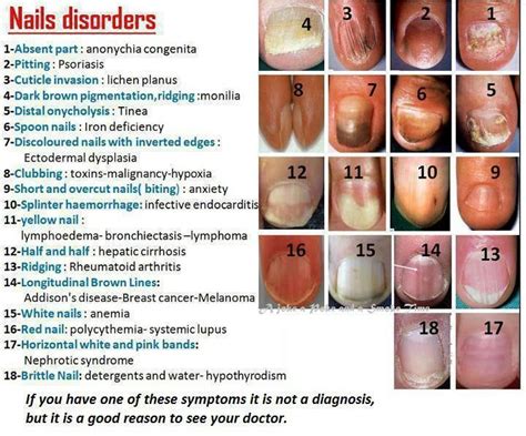 Nail diagnosis | Nail disorders, Fingernail health, Nail health