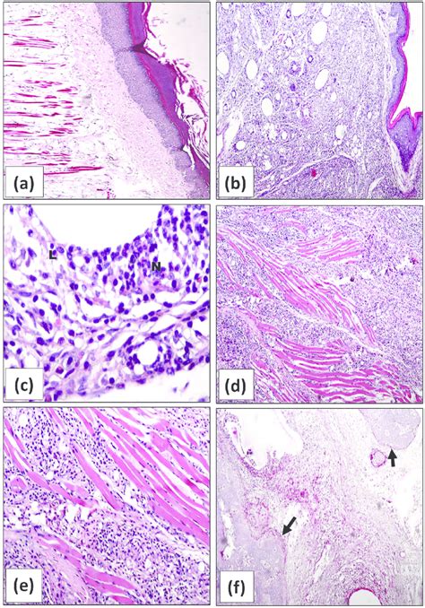 Representative Photomicrographs Of H E Stained Sections Of Rats Right