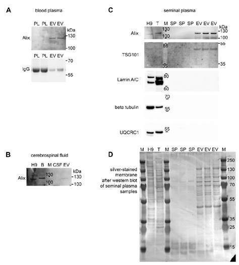 Ev Analysis By Western Blotting Proteins From Crude Body Fluids Blood