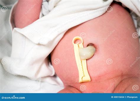 Umbilical Cord of Newborn Baby Stock Photo - Image of cute, children ...