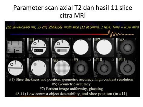 Mri Quality Control Acr Phantom Pro Mri