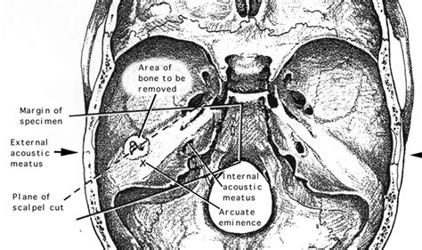 Eminence Definition Anatomy - Anatomical Charts & Posters