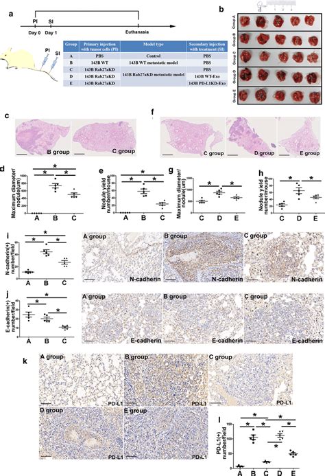 Osteosarcoma Derived Exosomes And Exosomal PD L1 Facilitate Pulmonary