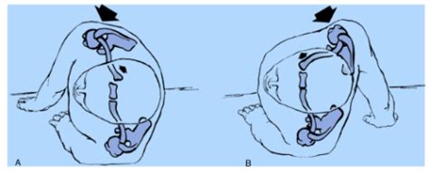 Sternoclavicular Joint Boston Shoulder Institute