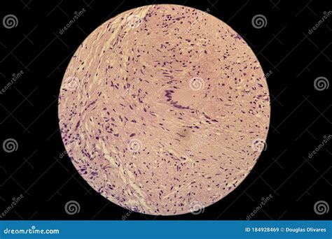 Langerhans Cells LC in Microscopic Slide Stock Image - Image of ...