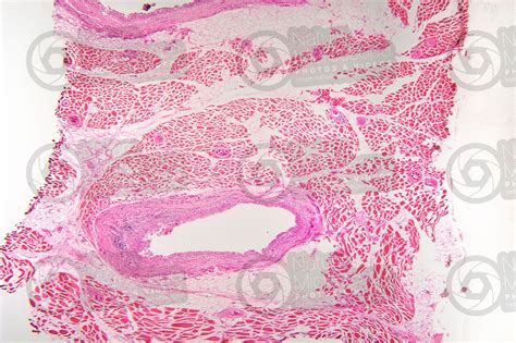 Mammifero Muscolatura Scheletrica Sezione Trasversale 32X