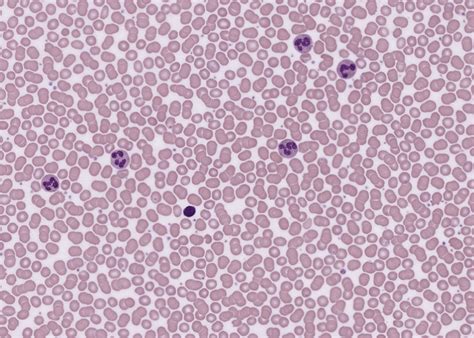 Blood – Meyers Histology