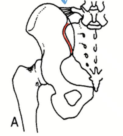 Spinal Biomechanics Lecture 1 Flashcards Quizlet