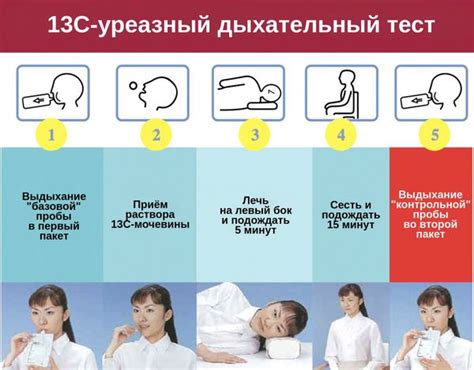 По характеру воспаления острый гастрит может быть любым