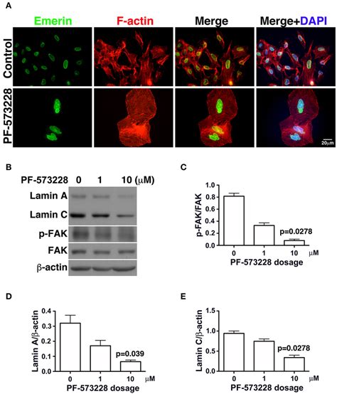 Downregulation Of Lamin A And Lamin C And Nuclear Deformity In A