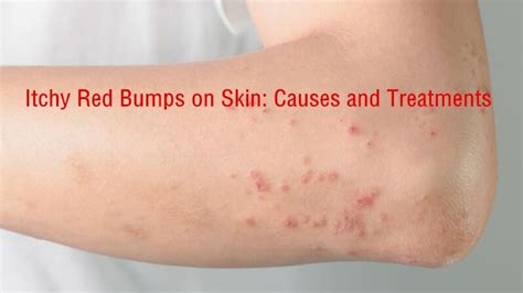 Red Bumps On Skin Rash